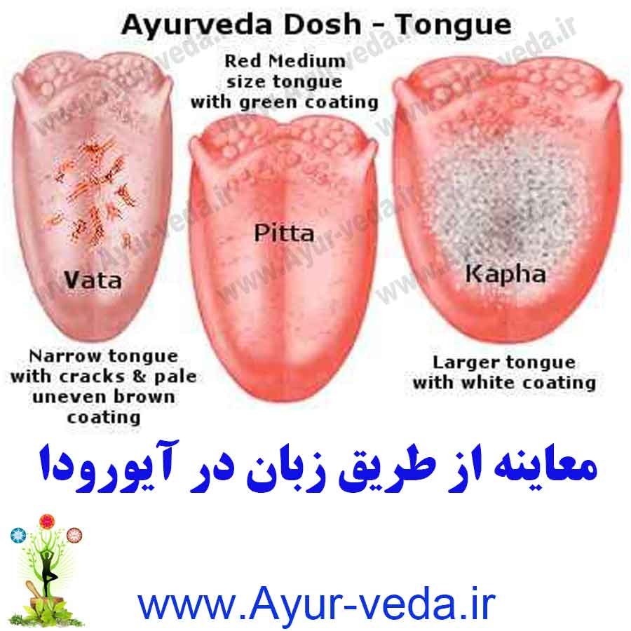 ayurveda Tongue diagnosis - معاینه از طریق زبان