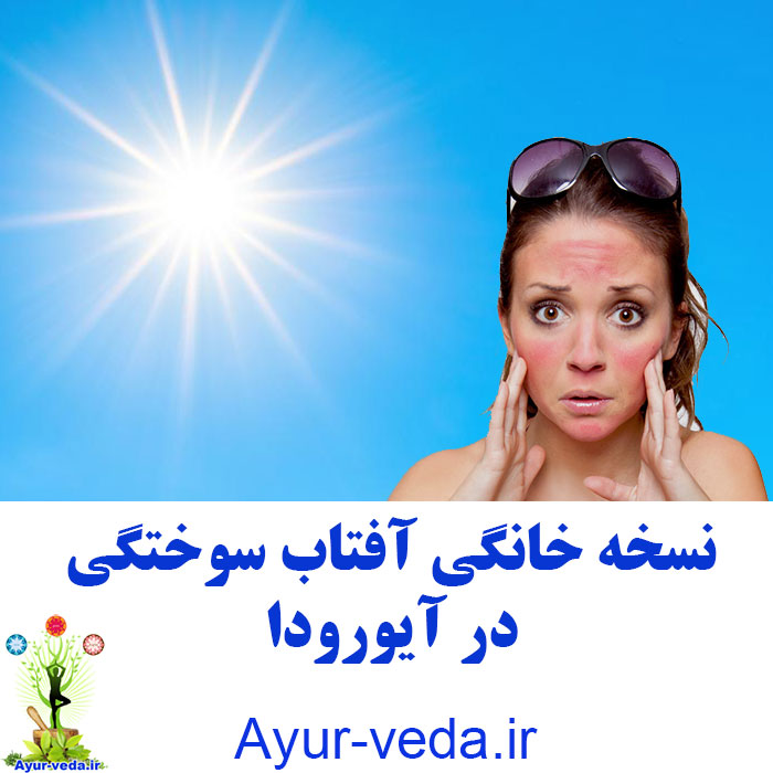 Sun burn in ayurveda - نسخه خانگی آفتاب سوختگی در آیورودا