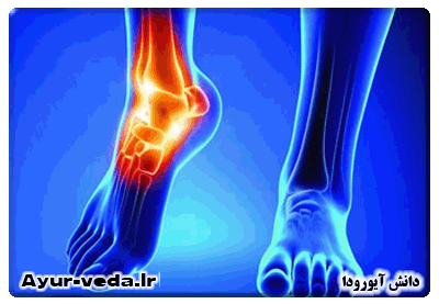  نکاتی در ارتباط درد مفاصل