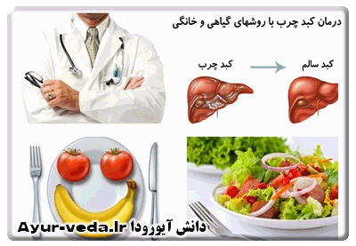 درمان كبد چرب با گياهان